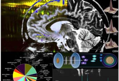 Brain tumor protein