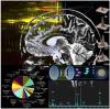 Brain tumor protein